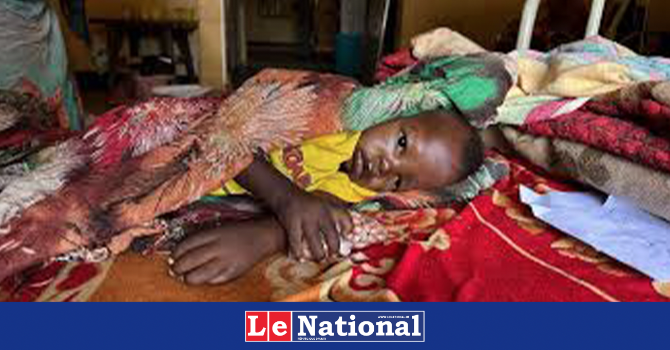 Malnutrition : au moins 14 millions d’enfants menacés par les coupes financières, alerte l’UNICEF